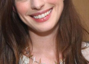 h ハリウッドスマイル003